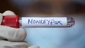 monkeypox
