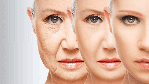 Reversal epigenetic